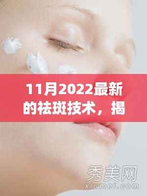 揭秘，最新祛斑技术重塑无瑕肌肤（2022年11月版）